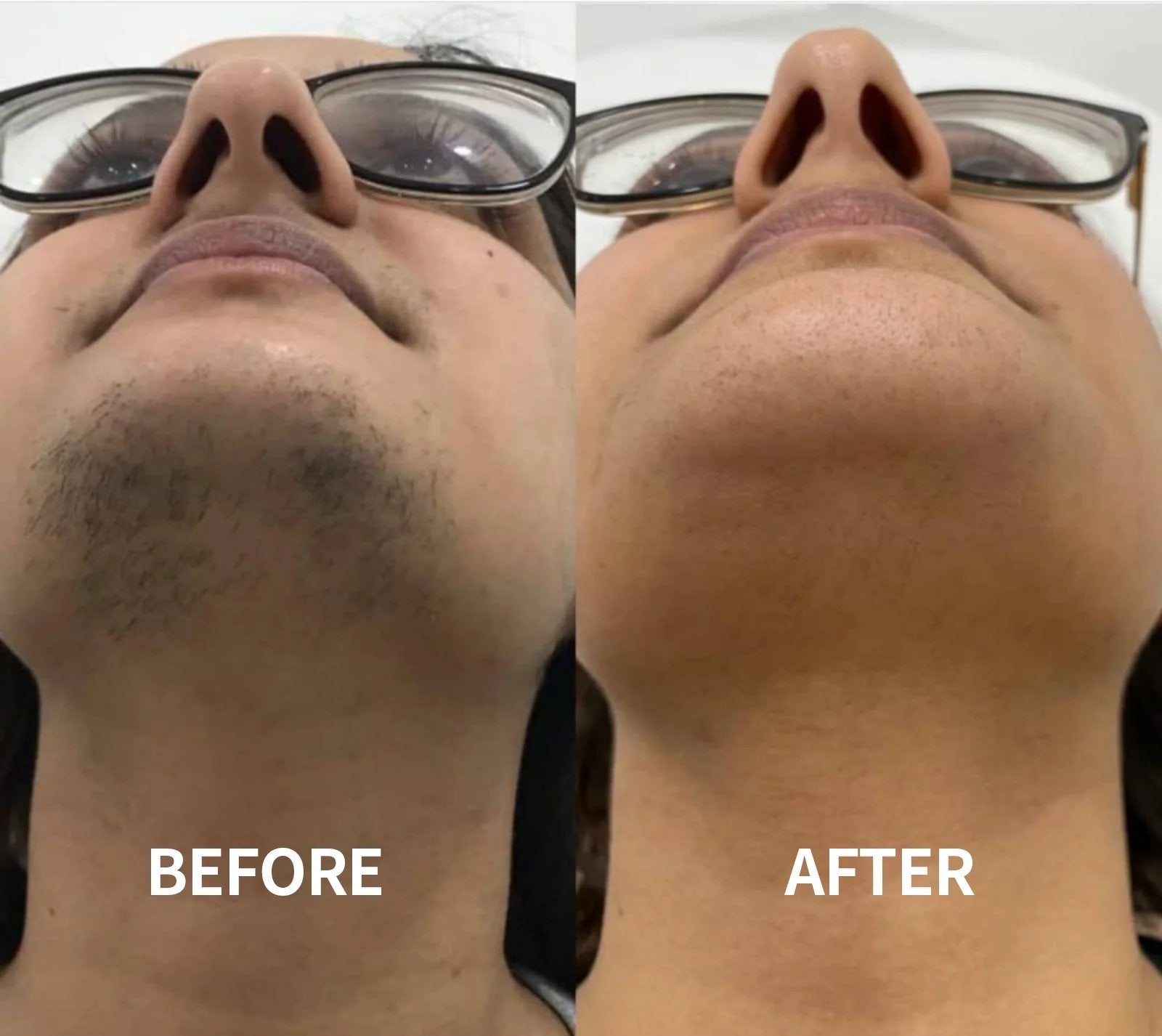 đ„Gentle and Painless Facial Hair Removal Cream