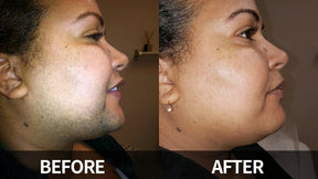 🔥Gentle and Painless Facial Hair Removal Cream