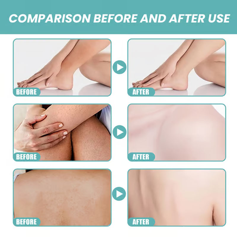 🛁 ✨ Ultra-Hydrating Bath & Shower Oil - For Silky Smooth Skin & Natural Mosquito Protection!